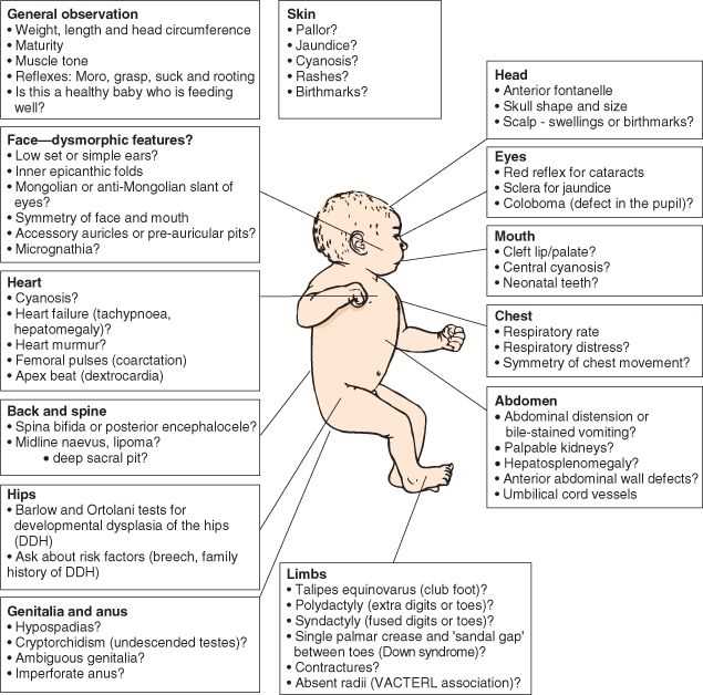 newborn physical exam checklist